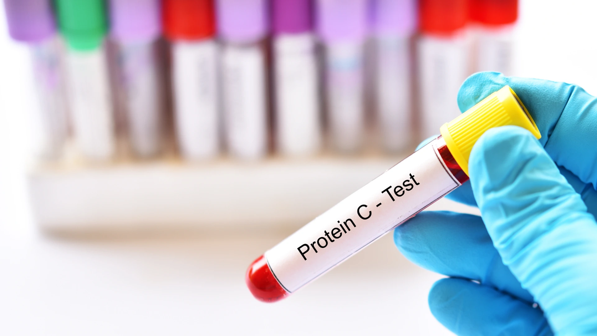 C-Reactive Protein